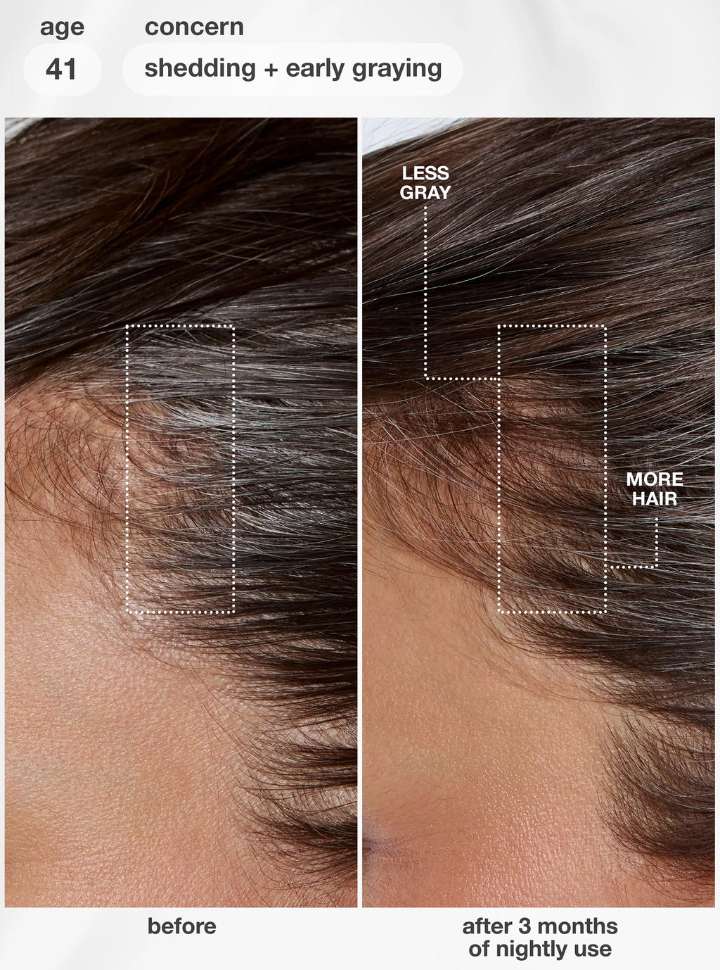 K18 FutureIQ biomimetic hair longevity serum image 2