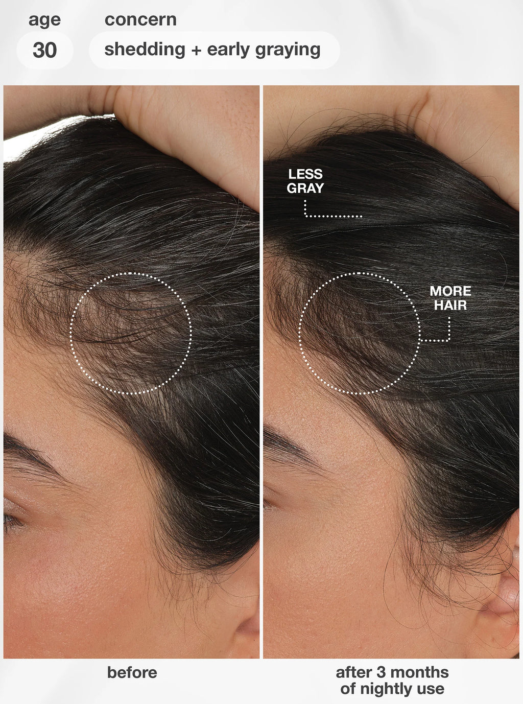 K18 FutureIQ biomimetic hair longevity serum image 3